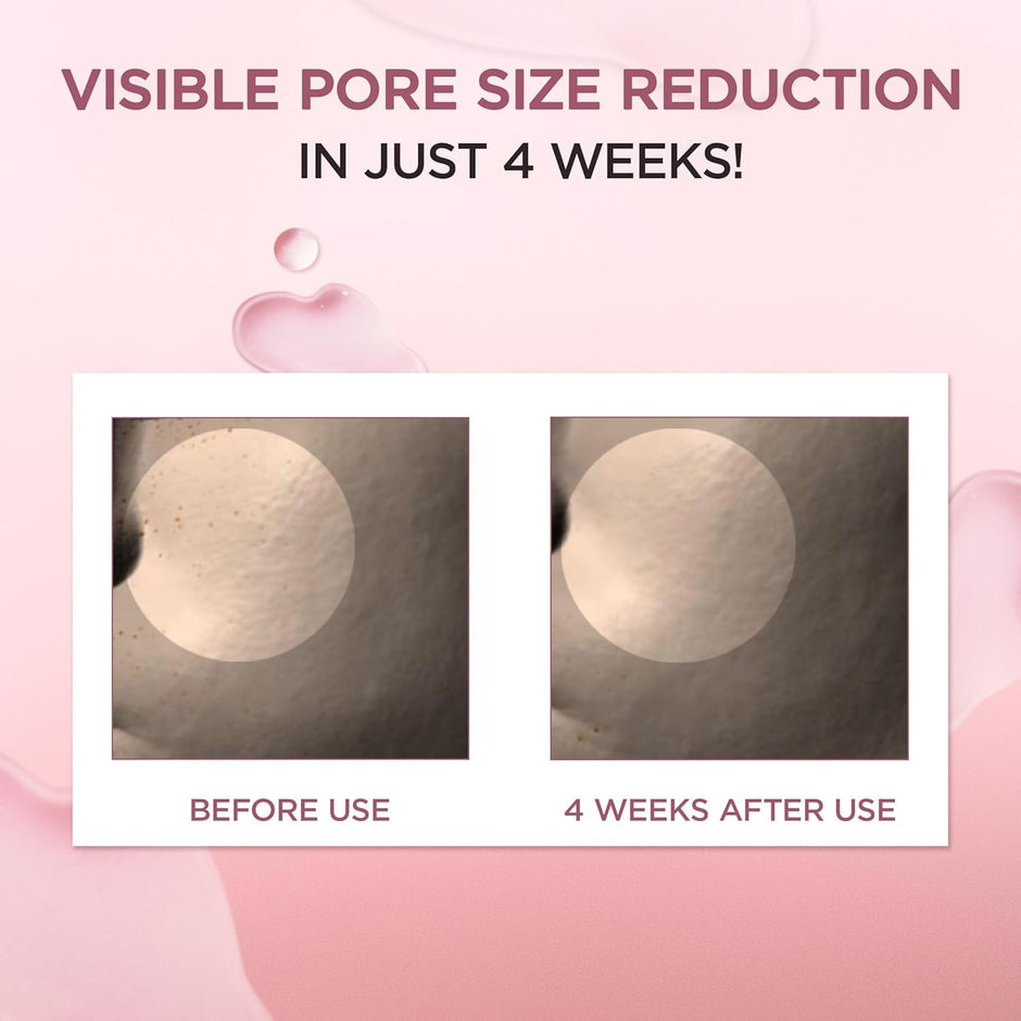 Revitalize Your Skin with Madagascar Centella Poremizing Fresh Ampoule - 3.38 Fl. Oz (100Ml) for Oily and Combination Skin | Soothing Hydration & Pore Cleansing
